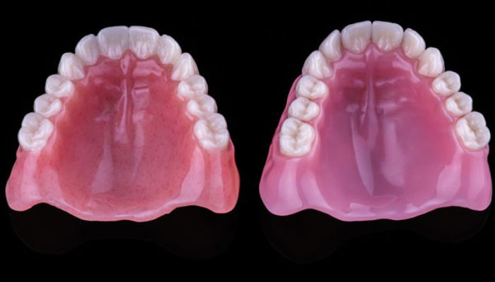  Bộ răng giả nằm bên trái được làm từ công nghệ in 3D và bên phải( bộ răng thật) 