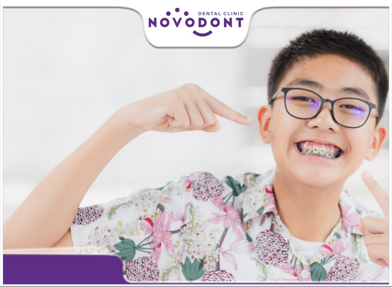 Bác sĩ nha khoa khuyến khích, nếu trẻ gặp vấn đề răng lệch lạc, nên niềng răng cho trẻ trong độ tuổi vàng