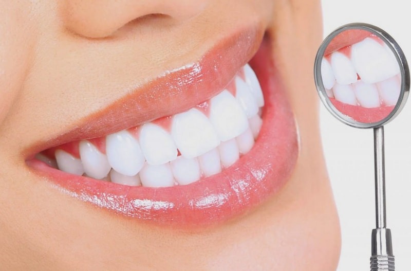  Công nghệ bọc răng sứ đem lại vẻ đẹp tự nhiên và tương thích giống răng thật 