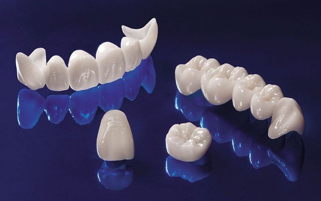  Công nghệ răng giả bằng sứ có độ bền cao 