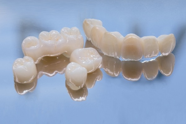 Sử dụng kỹ thuật số hóa trong quá trình tạo ra răng sứ phục vụ cho việc phục hình răng 