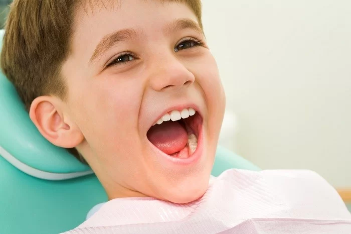 Niềng răng silicon giúp trẻ tự tin sở hữu một nụ cười đẹp