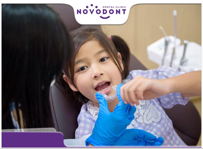 Niềng răng hàm trong suốt là phương pháp an toàn phù hợp với bé
