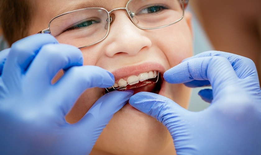Niềng răng tháo lắp có phải là phương pháp an toàn cho trẻ em? 