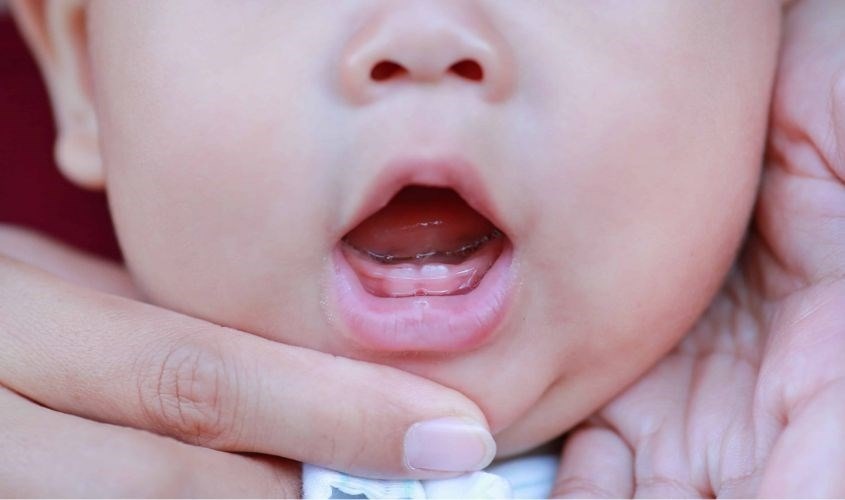 Dấu hiệu trẻ sắp mọc răng là thường xuyên chảy dãi