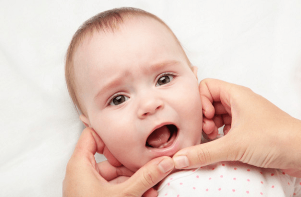 Những nguyên nhân khác nhau khiến trẻ chậm mọc răng