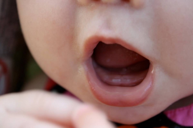 Yếu tố di truyền, dinh dưỡng  ảnh hưởng trực tiếp đến phát triển răng của trẻ