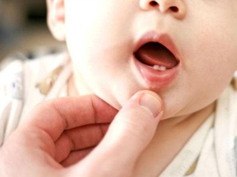 Trẻ mọc răng sớm không phải là vấn đề quá nghiêm trọng