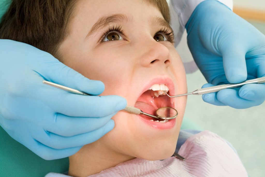 Trẻ bị sâu răng sữa phải làm sao?