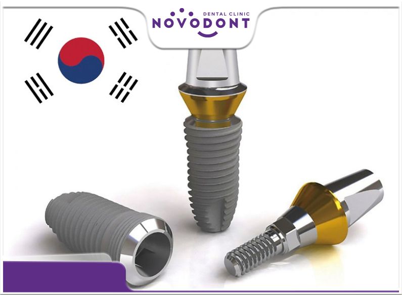 So với nhiều loại trụ implant khác, implant Hàn Quốc có mức giá khá mềm