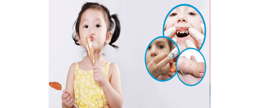 Nguyên nhân gây sún răng ở trẻ