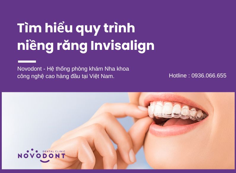 Quy trình niềng răng trong suốt invisalign