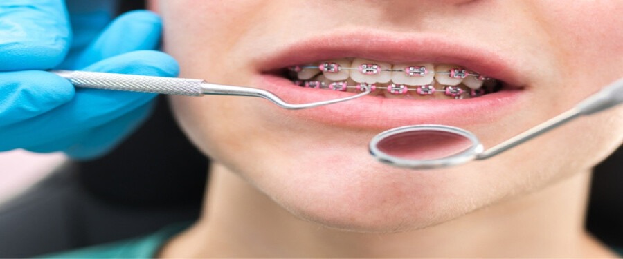 Các yếu tố ảnh hưởng đến mất răng số 6