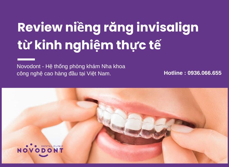 Tổng hợp niềng răng invisalign review từ thực tế