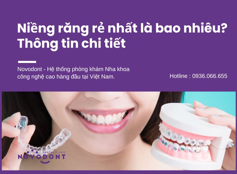 Niềng răng rẻ nhất là bao nhiêu?