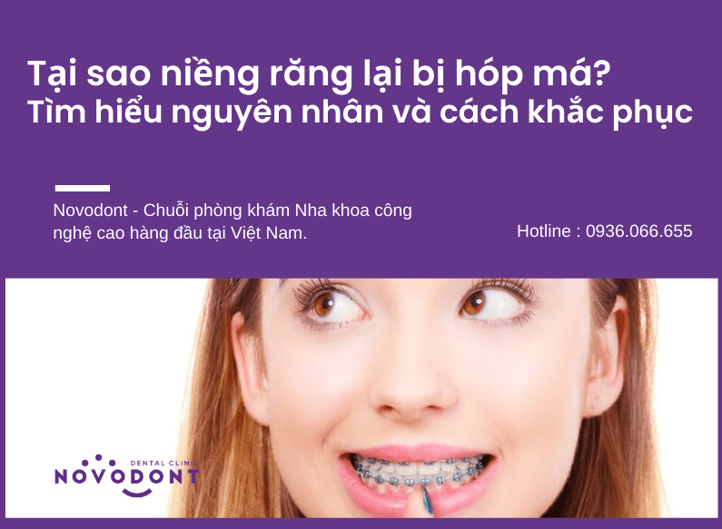 Tại sao niềng răng lại bị hóp má? Tìm hiểu nguyên nhân và cách khắc phục