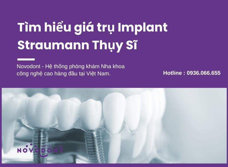 Giá Trụ Implant Straumann phụ thuộc vào nhiều yếu tố