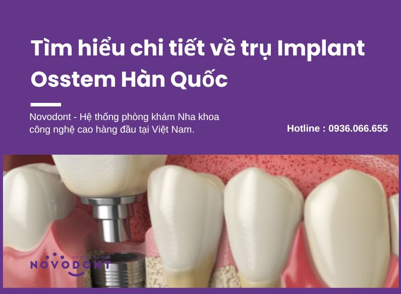 Trụ Implant Osstem được sản xuất bởi công ty Osstem Implant