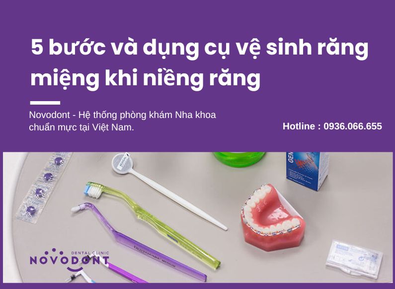 Tìm hiểu cách vệ sinh răng miệng khi niềng răng 
