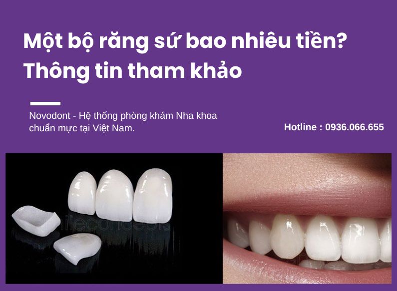Tham khảo giá 1 bộ răng sứ bao nhiêu tiền?