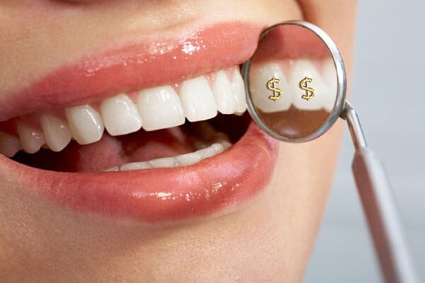 Giá trị của bọc răng sứ phụ thuộc vào chất liệu răng sứ 