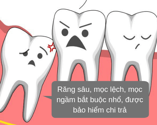 Chi phí nhổ răng khôn là bao nhiêu? Nhổ răng khôn được BHYT chi trả trong những trường hợp nào?