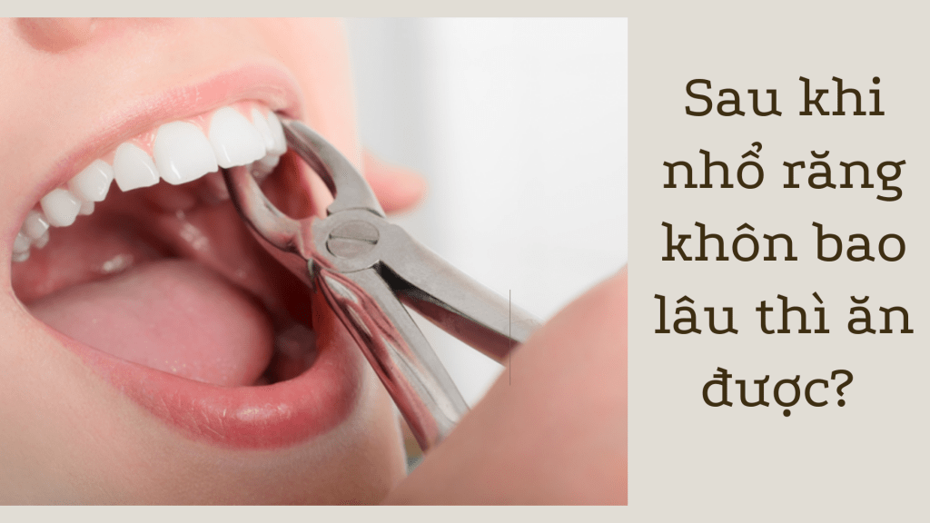 Sau khi nhổ răng khôn khoảng 4 đến 5 tiếng có thể ăn được đồ mềm.