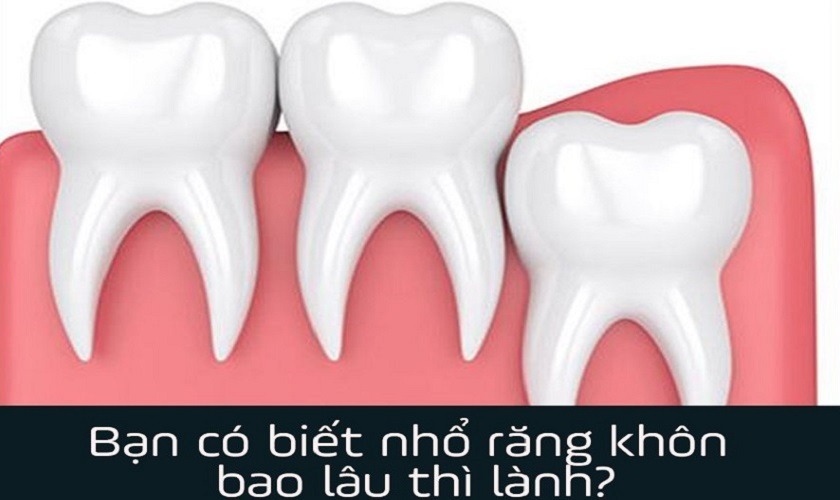 Nhổ răng khôn bao lâu thì lành 1 phần phụ thuộc vào tay nghề bác sĩ và môi trường vô khuẩn khi thực hiện