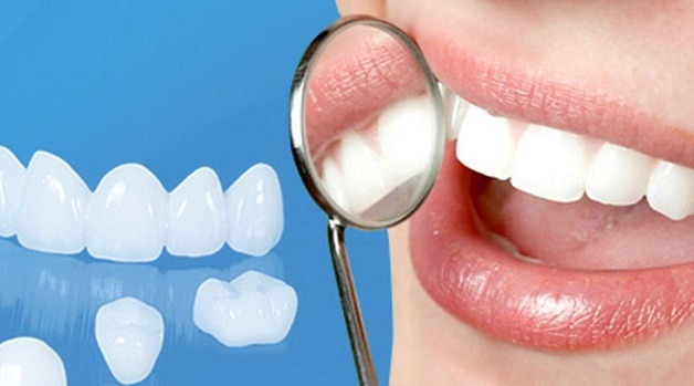 Bọc răng sứ hiện đang là xu hướng thẩm mỹ được nhiều khách hàng lựa chọn.