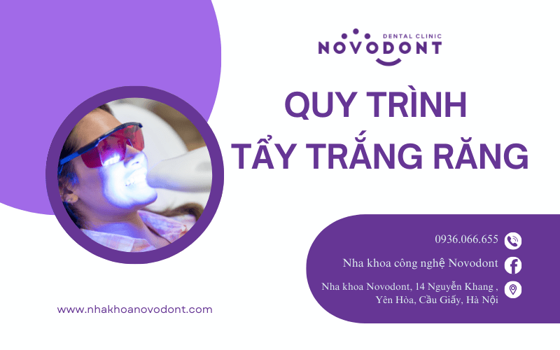 Quy trình tẩy trắng răng tại nha khoa Novodont